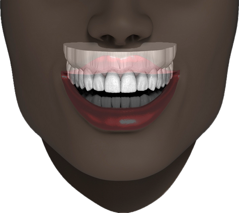 Наши специалисты могут разработать эстетический мокап зубов пациента
